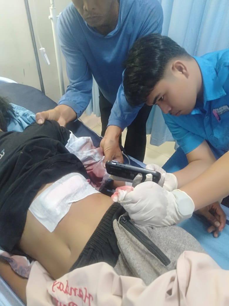 Pelajar SMA Diduga Jadi Korban Pembegalan di Desa Bumi Nabung, Lampung Utara